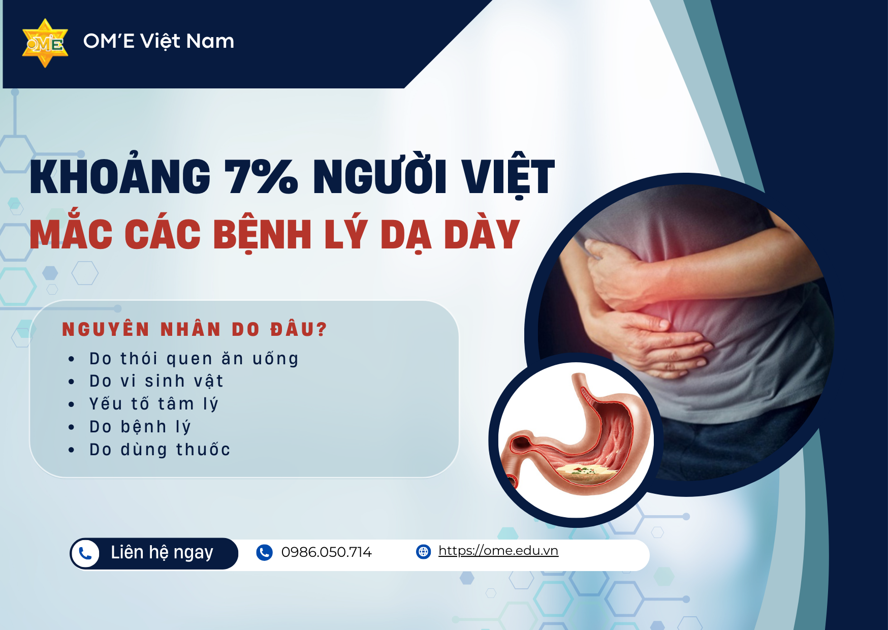 KHOẢNG 7% NGƯỜI VIỆT MẮC CÁC BỆNH LÝ VỀ DẠ DÀY. NGUYÊN NHÂN DO ĐÂU?