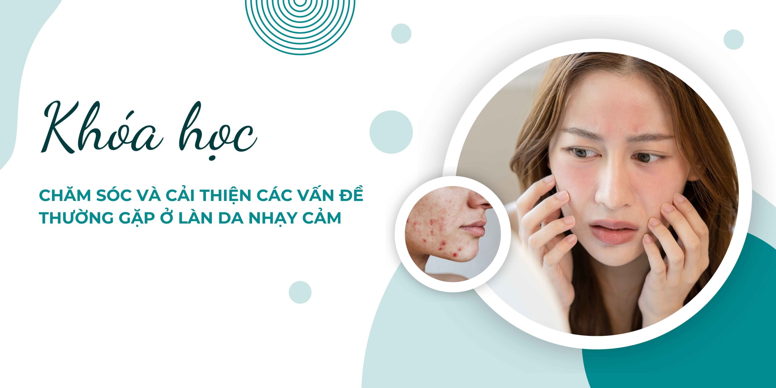 Chăm sóc và cải thiện các vấn đề thường gặp ở làn da nhạy cảm