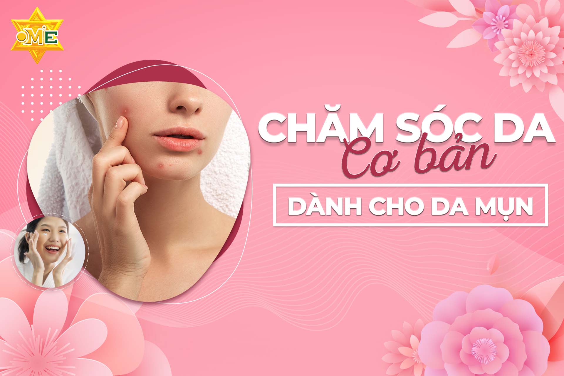 Chăm sóc da cơ bản dành cho da mụn