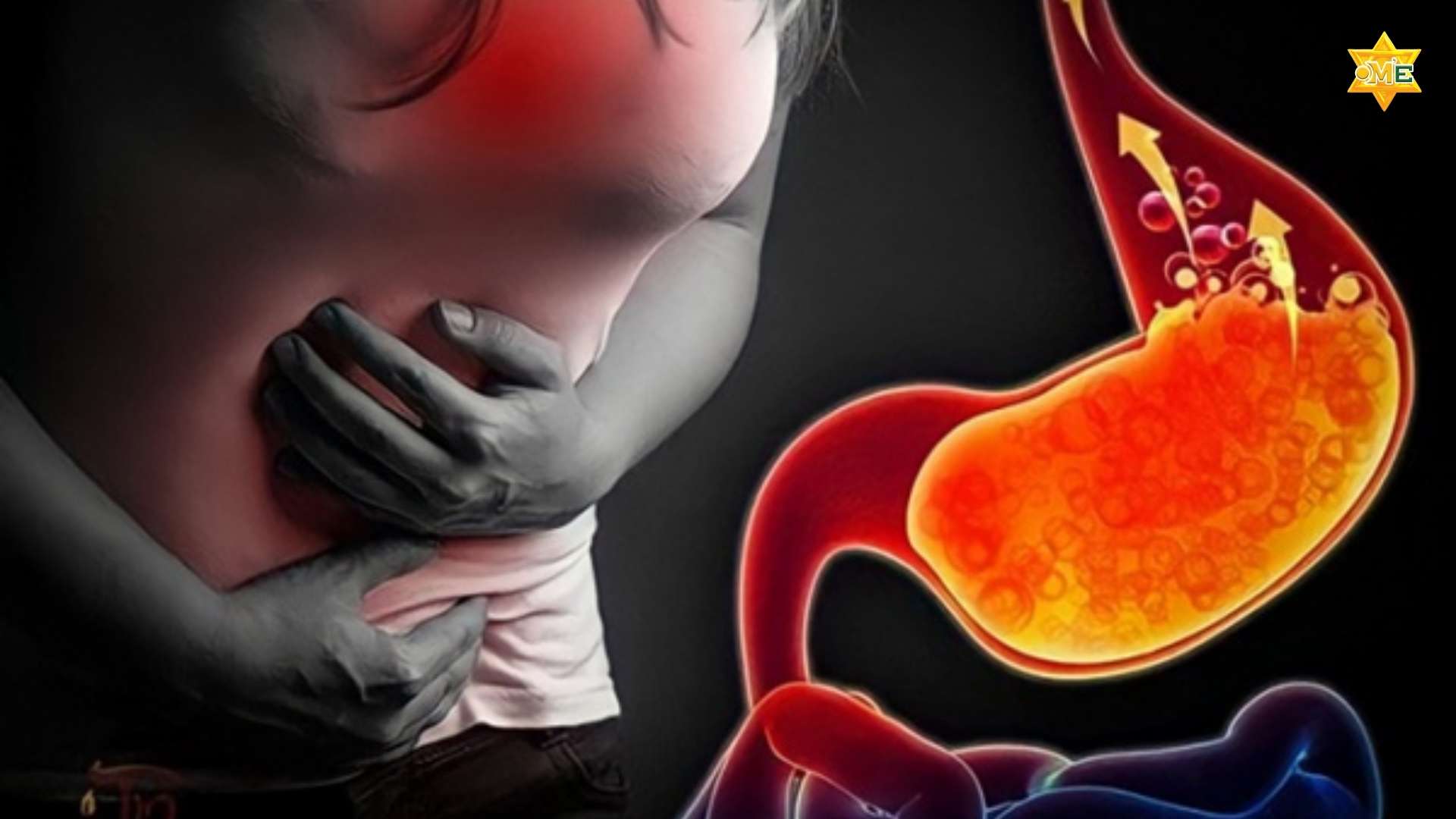 Hướng Dẫn Xoa Bóp Chữa Trào Ngược Dạ Dày Hiệu Quả Và An Toàn Tại Nhà