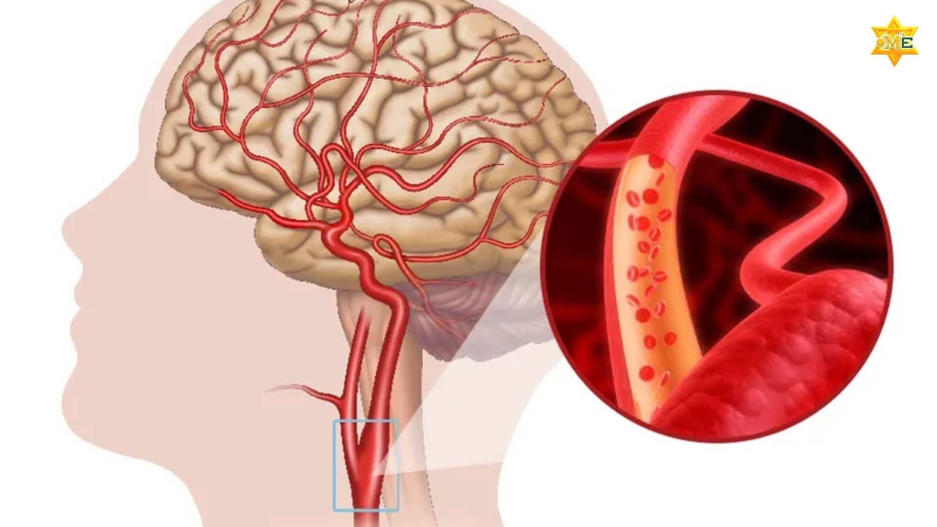 Hướng Dẫn Xoa Bóp Lưu Thông Máu Não Hiệu Quả Dễ Thực Hiện